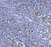 IHC staining of FFPE human tonsil tissue with MZB1 antibody. HIER: boil tissue sections in pH8 EDTA for 20 min and allow to cool before testing.