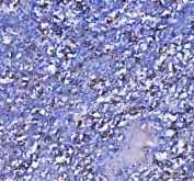 IHC staining of FFPE human tonsil tissue with MZB1 antibody. HIER: boil tissue sections in pH8 EDTA for 20 min and allow to cool before testing.