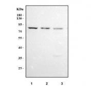 Western blot testing of human 1) Caco-2, 2) U-2 OS and 3) HepG2 cell lysate with LRRN4 antibody. Predicted molecular weight ~79 kDa but may be observed at higher molecular weights due to glycosylation.