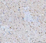 IHC staining of FFPE rat heart tissue with LEO1 antibody. HIER: boil tissue sections in pH8 EDTA for 20 min and allow to cool before testing.