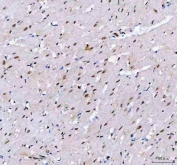 IHC staining of FFPE rat heart tissue with LEO1 antibody. HIER: boil tissue sections in pH8 EDTA for 20 min and allow to cool before testing.