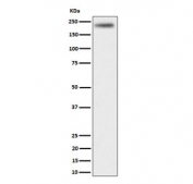Western blot testing of human HeLa cell lysate with DENN antibody. Predicted molecular weight ~176 kDa.