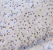 IHC staining of FFPE mouse brain tissue with LZIC antibody. HIER: boil tissue sections in pH8 EDTA for 20 min and allow to cool before testing.