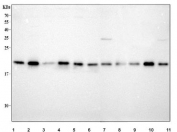 Western blot testing of 1) human PC-3, 2) human HepG2, 3) human 293T, 4) human K562, 5) human HEL, 6) human Jurkat, 7) rat brain, 8) rat thymus, 9) mouse brain, 10) mouse thymus and 11) mouse NIH 3T3 cell lysate with LZIC antibody. Predicted molecular weight ~21 kDa.