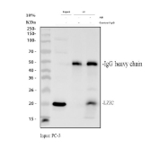 Immunoprecipitation of LZIC protein from 500ug of human PC-3 whole cell lysate with 2ug of LZIC antibody.