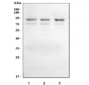 Western blot testing of 1) human 293T, 2) human HeLa and 3) human MOLT4 cell lysate with L3MBTL2 antibody. Predicted molecular weight: 79 kDa and 69 kDa (multiple isoforms).