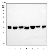 Western blot testing of human 1) 293T, 2) HeLa, 3) HepG2, 4) Jurkat, 5) Caco-2, 6) A431 and 7) PC-3 cell lysate with LRRC59 antibody. Predicted molecular weight ~35 kDa.