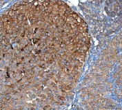 IHC staining of FFPE mouse ovary tissue with OTUB1 antibody. HIER: boil tissue sections in pH8 EDTA for 20 min and allow to cool before testing.