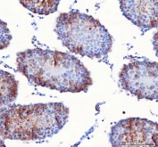 IHC staining of FFPE rat testis tissue with CMG-1 antibody. HIER: boil tissue sections in pH8 EDTA for 20 min and allow to cool before testing.