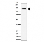 Western blot testing of human HeLa cell lysate with IPO9 antibody. Predicted molecular weight ~116 kDa, but it is often observed at higher molecular weights due to protein complexing.