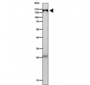 Western blot testing of mouse lung tissue lysate with IPO9 antibody. Predicted molecular weight ~116 kDa, but it is often observed at higher molecular weights due to protein complexing.