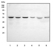Western blot testing of 1) human Caco-2, 2) human Jurkat, 3) human MCF7, 4) human RT4, 5) rat brain and 6) mouse heart tissue lysate with RAB3IP antibody. Predicted molecular weight ~53 kDa with multiple isoforms.