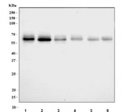 Western blot testing of 1) human HepG2, 2) human Caco-2, 3) human A431, 4) human HaCaT, 5) mouse liver and 6) rat liver tissue lysate with MCCC1 antibody. Predicted molecular weight ~80 kDa.