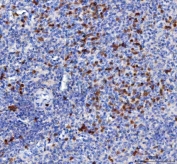 IHC staining of FFPE human spleen tissue with MIP-3 beta antibody. HIER: boil tissue sections in pH8 EDTA for 20 min and allow to cool before testing.