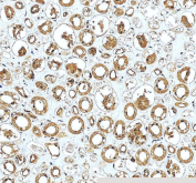 PARD6B Antibody Human Kidney IHC. Immunohistochemistry staining of FFPE human kidney tissue with PARD6B antibody. HIER: boil tissue sections in pH8 EDTA for 20 min and allow to cool before testing.