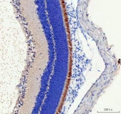IHC staining of FFPE rat retina tissue with IMPG2 antibody. HIER: boil tissue sections in pH8 EDTA for 20 min and allow to cool before testing.