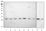Western blot testing of 1) human A549, 2) human HeLa, 3) human A431, 4) human HepG2, 5) human HaCaT, 6) human MCF7, 7) human HEL, 8) rat RH35 and 9) mouse HEPA1-6 cell lysate with LHPP antibody. Predicted molecular weight ~29 kDa.