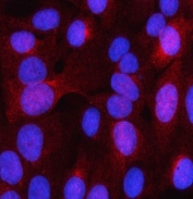 Immunofluorescent staining of FFPE human U-2 OS cells with LHPP antibody (red) and DAPI nuclear stain (blue). HIER: steam section in pH6 citrate buffer for 20 min.