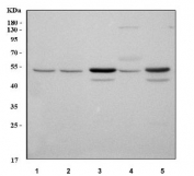 Western blot testing of 1) human K562, 2) human MCF7, 3) rat brain, 4) rat testis and 5) mouse brain tissue lysate with Thioredoxin-interacting protein antibody. Predicted molecular weight: ~44 kDa and ~37 kDa (two isoforms).