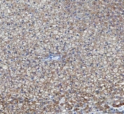 IHC staining of FFPE rat alcoholic liver tissue with LDAH antibody. HIER: boil tissue sections in pH8 EDTA for 20 min and allow to cool before testing.