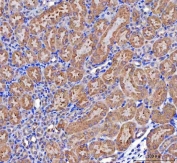 IHC staining of FFPE mouse kidney tissue with MCCC2 antibody. HIER: boil tissue sections in pH8 EDTA for 20 min and allow to cool before testing.