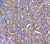 IHC staining of FFPE rat kidney tissue with MCCC2 antibody. HIER: boil tissue sections in pH8 EDTA for 20 min and allow to cool before testing.