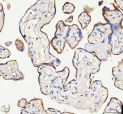 IHC staining of FFPE human placental tissue with IARS2 antibody. HIER: boil tissue sections in pH8 EDTA for 20 min and allow to cool before testing.