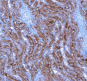 IHC staining of FFPE rat kidney tissue with IARS2 antibody. HIER: boil tissue sections in pH8 EDTA for 20 min and allow to cool before testing.