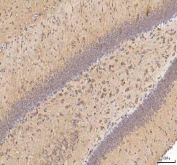 IHC staining of FFPE rat brain tissue with BPNT2 antibody. HIER: boil tissue sections in pH8 EDTA for 20 min and allow to cool before testing.