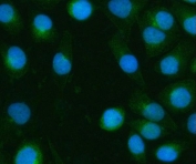 Immunofluorescent staining of FFPE human SiHa cells with BPNT2 antibody (red) and DAPI nuclear stain (blue). HIER: steam section in pH6 citrate buffer for 20 min.