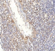 IHC staining of FFPE human tonsil tissue with BPNT2 antibody. HIER: boil tissue sections in pH8 EDTA for 20 min and allow to cool before testing.