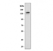 Western blot testing of human U-251 cell lysate with MAGEL2 antibody. Predicted molecular weight ~133 kDa.