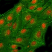 Immunofluorescent staining of FFPE human A549 cells with NSFL1C antibody (red) and Beta Tubulin mAb (green). HIER: steam section in pH6 citrate buffer for 20 min.