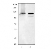 Western blot testing of human 1) HaCat and 2) K562 cell lysate with MAN1 antibody. Predicted molecular weight ~100 kDa, commonly observed at 100-110 kDa.