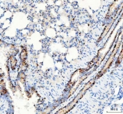 IHC staining of FFPE rat lung tissue with PARP3 antibody. HIER: boil tissue sections in pH8 EDTA for 20 min and allow to cool before testing.