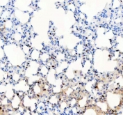 IHC staining of FFPE mouse lung tissue with PARP3 antibody. HIER: boil tissue sections in pH8 EDTA for 20 min and allow to cool before testing.