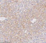 IHC staining of FFPE mouse liver tissue with Hydroxyacid oxidase 1 antibody. HIER: boil tissue sections in pH8 EDTA for 20 min and allow to cool before testing.