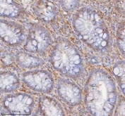 IHC staining of FFPE human colon tissue with SHKBP1 antibody. HIER: boil tissue sections in pH8 EDTA for 20 min and allow to cool before testing.