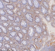 IHC staining of FFPE human colon tissue with SHKBP1 antibody. HIER: boil tissue sections in pH8 EDTA for 20 min and allow to cool before testing.