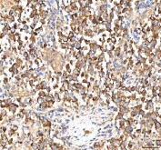IHC staining of FFPE human testicular seminoma tissue with ITPA antibody. HIER: boil tissue sections in pH8 EDTA for 20 min and allow to cool before testing.