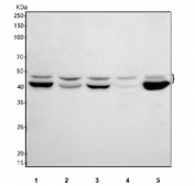 Western blot testing of 1) human Jurkat, 2) human MCF7, 3) human HEL, 4) mouse testis and 5) mouse RAW264.7 cell lysate with HEMT1 antibody. Predicted molecular weight ~45 kDa with multiple isoforms.