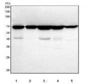 Western blot testing of 1) human CCRF-CEM, 2) human COLO-320, 3) human SW620, 4) human 293T and 5) rat kidney tissue lysate with SLC6A20 antibody. Predicted molecular weight ~66 kDa.