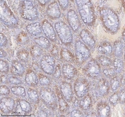 IHC staining of FFPE human colon tissue with SLC6A20 antibody. HIER: boil tissue sections in pH8 EDTA for 20 min and allow to cool before testing.