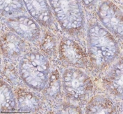 IHC staining of FFPE human colon tissue with SLC6A20 antibody. HIER: boil tissue sections in pH8 EDTA for 20 min and allow to cool before testing.