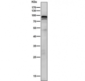 Western blot testing of rat skin tissue lysate with Phospho-STAT3 antibody.