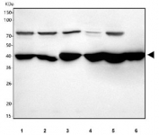 Western blot testing of 1) human 293T, 2) human HepG2, 3) rat liver, 4) rat kidney, 5) mouse liver and 6) mouse kidney tissue lysate with HAOX2 antibody. Predicted molecular weight: ~39 kDa.