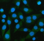 Immunofluorescent staining of FFPE human SiHa cells with PCMT1 antibody (green) and DAPI nuclear stain (blue). HIER: steam section in pH6 citrate buffer for 20 min.