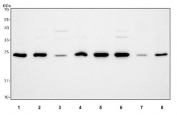 Western blot testing of 1) rat testis, 2) rat brain, 3) rat liver, 4) rat PC-12, 5) mouse testis, 6) mouse brain, 7) mouse liver and 8) mouse NIH 3T3 cell lysate with PCMT1 antibody. Predicted molecular weight ~25 kDa.