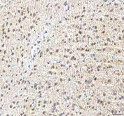 IHC staining of FFPE rat brain tissue with PCMT1 antibody. HIER: boil tissue sections in pH8 EDTA for 20 min and allow to cool before testing.