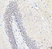 IHC staining of FFPE rat brain tissue with PCMT1 antibody. HIER: boil tissue sections in pH8 EDTA for 20 min and allow to cool before testing.